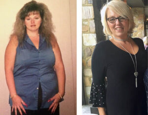 How cancer was my saving grace